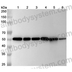 抗体：Human TUBA1B/Alpha Tubulin Antibody (SAA0528) RHF62201