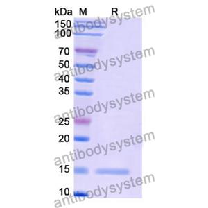 Anti-Human CD339/JAG1 Nanobody (SAA1285)