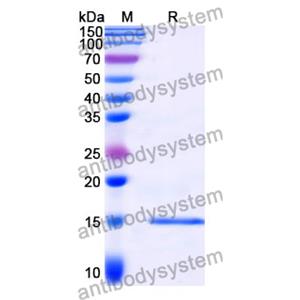 Anti-Clostridium botulinum BoNT/B Nanobody (SAA0939)