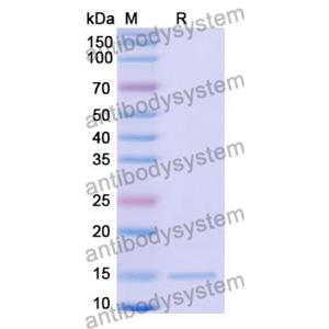 抗 Human LMO2 纳米抗体 (SAA1172)(RHD68301),Anti-Human LMO2 Nanobody (SAA1172)