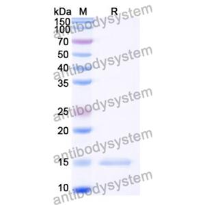 抗 Castor bean Ricin 納米抗體 (SAA0990)(RZZ01808),Anti-Castor bean Ricin Nanobody (SAA0990)