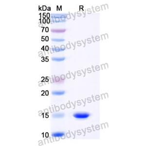 抗 Castor bean Ricin 納米抗體 (SAA0991)(RZZ01809),Anti-Castor bean Ricin Nanobody (SAA0991)