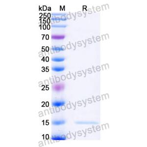 抗 Castor bean Ricin 納米抗體 (SAA1001)(RZZ01813),Anti-Castor bean Ricin Nanobody (SAA1001)