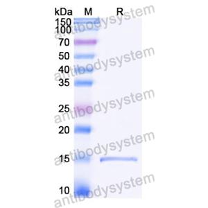 抗 Castor bean Ricin 納米抗體 (SAA1119)(RZZ01817),Anti-Castor bean Ricin Nanobody (SAA1119)