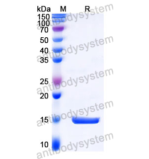 抗 Castor bean Ricin 納米抗體 (SAA1149)(RZZ01824),Anti-Castor bean Ricin Nanobody (SAA1149)