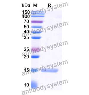 抗 Human CD197/CCR7 納米抗體 (SAA1349)(RHD99502),Anti-Human CD197/CCR7 Nanobody (SAA1349)