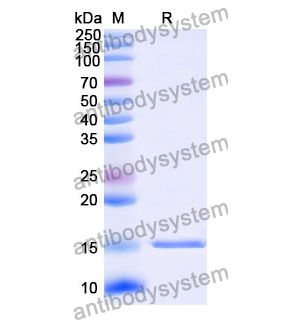 抗 Human CD32b/FCGR2B 纳米抗体 (SAA1313)(RHD97901),Anti-Human CD32b/FCGR2B Nanobody (SAA1313)