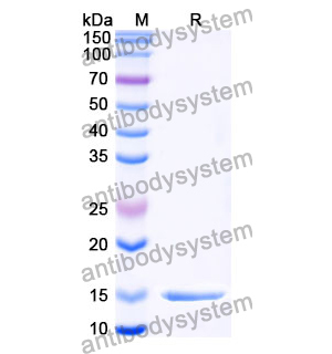 抗 Clostridium botulinum botA/BOTOX 纳米抗体 (SAA0930)(RXX00910),Anti-Clostridium botulinum botA/BOTOX Nanobody (SAA0930)