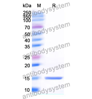 抗 Human SLC10A1 納米抗體 (SAA1065)(RHG93502),Anti-Human SLC10A1 Nanobody (SAA1065)