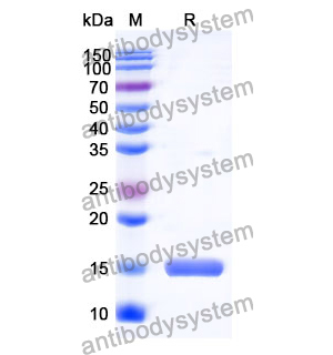 抗 Human ALB 纳米抗体 (SAA1154)(RHC01404),Anti-Human ALB Nanobody (SAA1154)