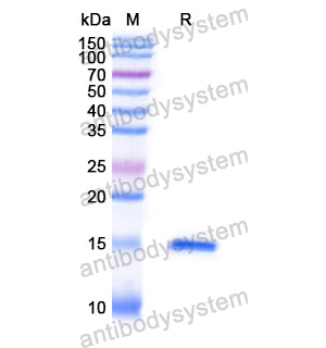 抗 Human KLB/Beta-klotho 纳米抗体 (SAA1184)(RHJ17801),Anti-Human KLB/Beta-klotho Nanobody (SAA1184)