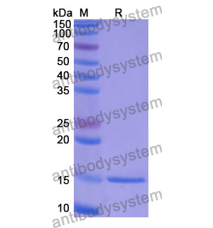 抗 Human GP2 納米抗體 (SAA1240)(RHF11201),Anti-Human GP2 Nanobody (SAA1240)