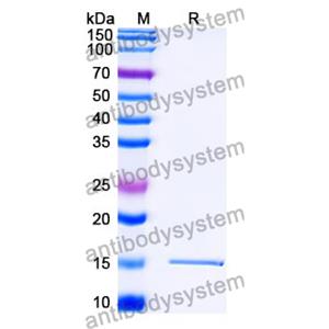 抗 SARS-CoV-2 S Protein 納米抗體 (SAA1100)(RVV00178),Anti-SARS-CoV-2 S Protein Nanobody (SAA1100)