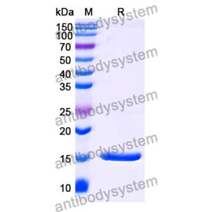 抗 Human PLAU 納米抗體 (SAA1008)(RHB88301),Anti-Human PLAU Nanobody (SAA1008)