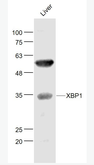 Anti-XBP1 antibody-細(xì)胞核轉(zhuǎn)錄因子X盒結(jié)合蛋白抗體,XBP1