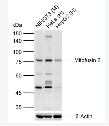 Anti-Mitofusin 2 antibody-线粒体融合蛋白Mfn2单克隆抗体,Mitofusin 2
