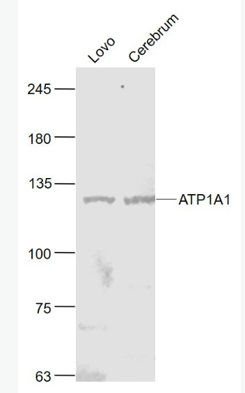 Anti-ATP1A1(Loading Control) antibody-鈉鉀ATP酶蛋白a1（內(nèi)參）抗體,ATP1A1(Loading Control)