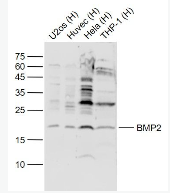 Anti-BMP2 antibody-骨形態(tài)發(fā)生蛋白2抗體,BMP2