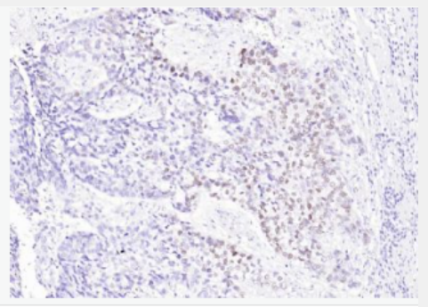 Anti-P63  antibody-腫瘤抑制基因p63α單克隆抗體,P63