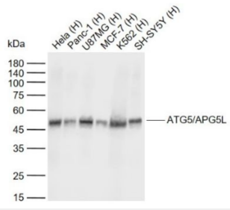 Anti-ATG5/APG5L antibody-自噬蛋白5單克隆抗體,ATG5/APG5L