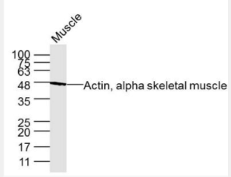 Anti-Actin, alpha skeletal muscle antibody-肌动蛋白α1单克隆抗体,Actin, alpha skeletal muscle