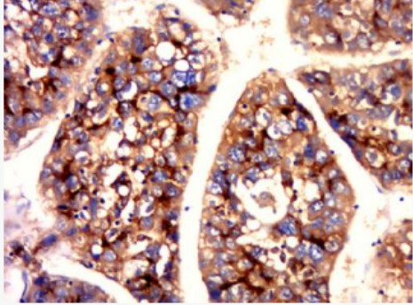 Anti-CEA(B5) antibody-癌胚抗原單克隆抗體（檢測）,CEA(B5)