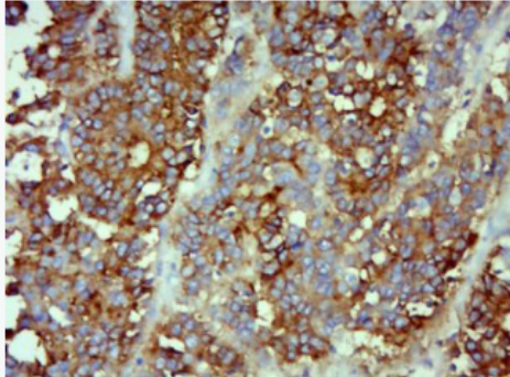 Anti-CEA(C3) antibody-癌胚抗原单克隆抗体（包被）,CEA(C3)