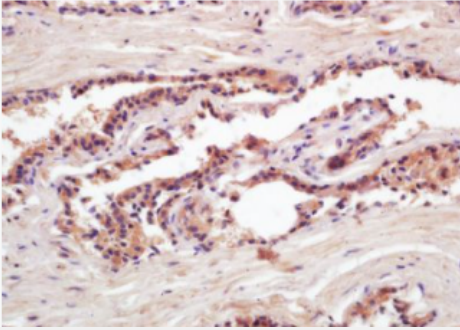 Anti-PSA(Pa3)antibody-人前列腺特异性抗原单克隆抗体(包被),PSA(Pa3)