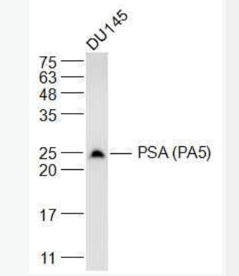 Anti-PSA (PA5)  antibody-人前列腺特異性抗原單克隆抗體(檢測(cè)),PSA (PA5)