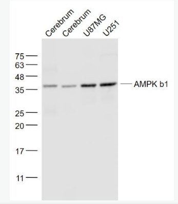 Anti-AMPK b1 antibody-腺苷单磷酸活化蛋白激酶β1单克隆抗体,AMPK b1