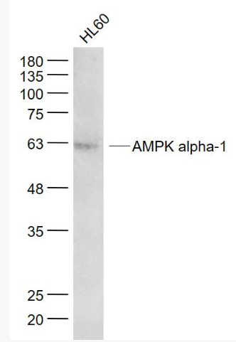 Anti-AMPK alpha-1 antibody-腺苷单磷酸活化蛋白激酶α1/AMPK α 1单克隆抗体,AMPK alpha-1