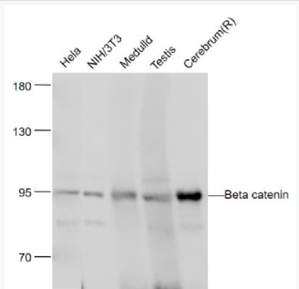 Anti-Beta catenin antibody-β-连环蛋白/β-连环素/β链接素单克隆抗体,Beta catenin