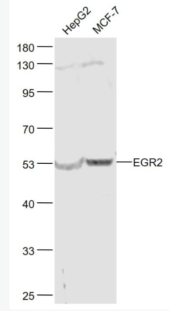 Anti-EGR2  antibody-早期生長反應(yīng)蛋白2抗體,EGR2