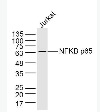 Anti-NFKB p65 antibody-细胞核因子/k基因结合核因子单克隆抗体,NFKB p65
