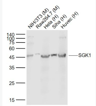 Anti-SGK1 antibody-糖皮质激素调节激酶1单克隆抗体,SGK1