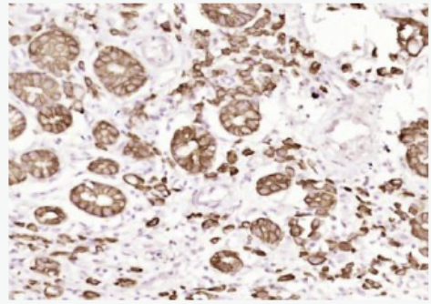 Anti-Pan Cytokeratin  antibody-广谱细胞角蛋白PCK单克隆抗体,Pan Cytokeratin