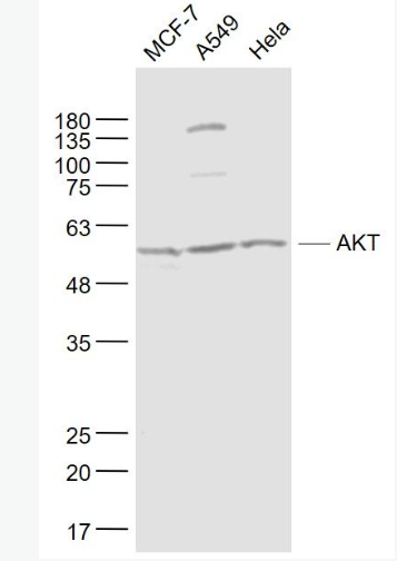 Anti-AKT antibody-蛋白激酶B單克隆抗體,AKT