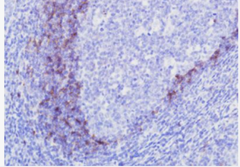 Anti-CD23 antibody-CD23/FcεRII單克隆抗體,CD23