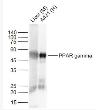 Anti-PPAR gamma antibody-过氧化酶活化增生受体γ单克隆抗体,PPAR gamma
