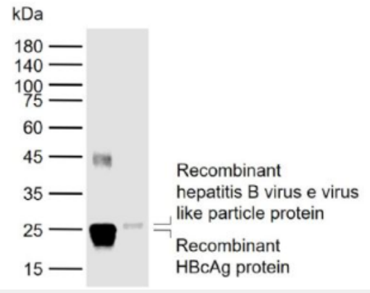 Anti-HBeAg  antibody-人乙型肝炎e抗原单克隆（包被）抗体,HBeAg