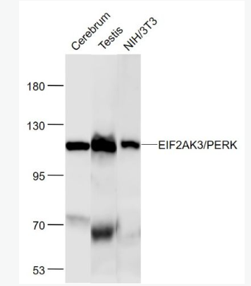 Anti-EIF2AK3/PERK  antibody-蛋白激酶样内质网激酶单克隆抗体,EIF2AK3/PERK