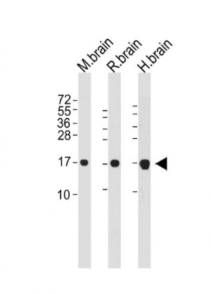 Anti-LC3  antibody-自噬微管相关蛋白轻链3单克隆抗体,LC3