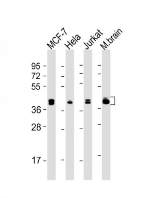 Anti-ERK1 antibody-丝裂原活化蛋白激酶1(MAPK3/1)单克隆抗体,ERK1