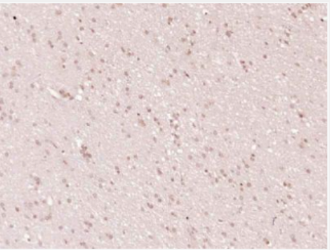 Anti-Cleaved PARP1 antibody-多腺苷二磷酸多聚酶/多聚ADP-核糖聚合酶1單克隆抗體,Cleaved PARP1