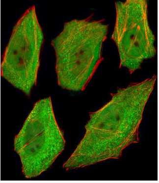 Anti-TNF alpha antibody-肿瘤坏死因子-α单克隆抗体,TNF alpha