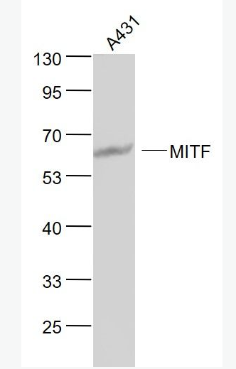 Anti-MITF antibody-微小细胞血症相关转录因子单克隆抗体,MITF