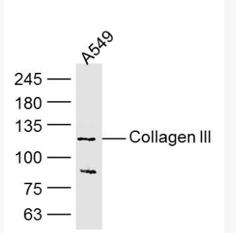 Anti-Collagen III antibody-III型胶原单克隆抗体,Collagen III