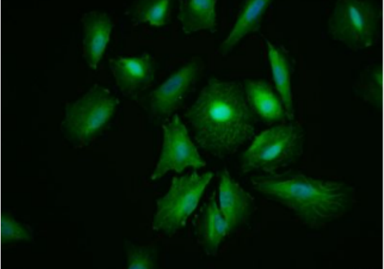 Anti-HSV-Tag antibody-HSV tag標簽單克隆抗體,HSV-Tag