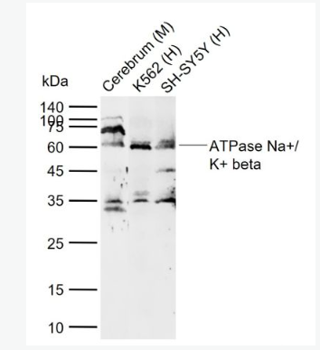 Anti-ATPase Na+/ K+ beta 2antibody-钠钾ATP酶通道蛋白抗体,ATPase Na+/ K+ beta 2