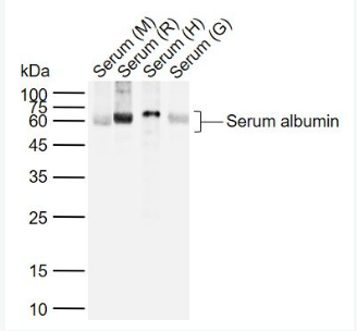 Anti-Human Serum albumin (Loading Control) antibody-白蛋白（内参）抗体,Human Serum albumin (Loading Control)